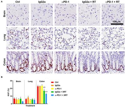 Sub-acute Toxicity in Non-cancerous Tissue and Immune-Related Adverse Events of a Novel Combination Therapy for Cancer